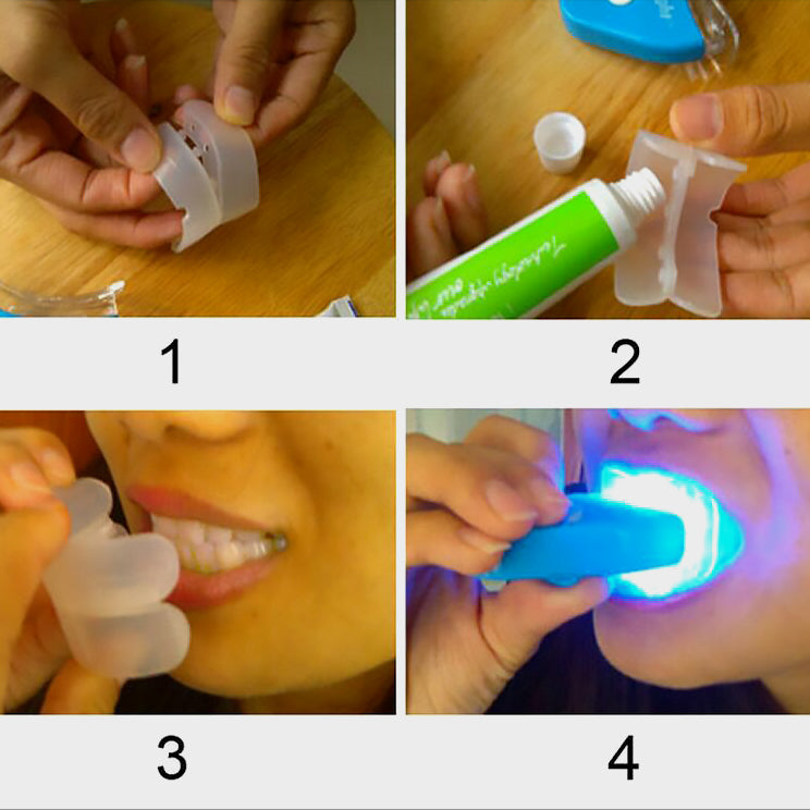 LED Teeth Whitening Kit - Professional At-Home Dental Bleaching System