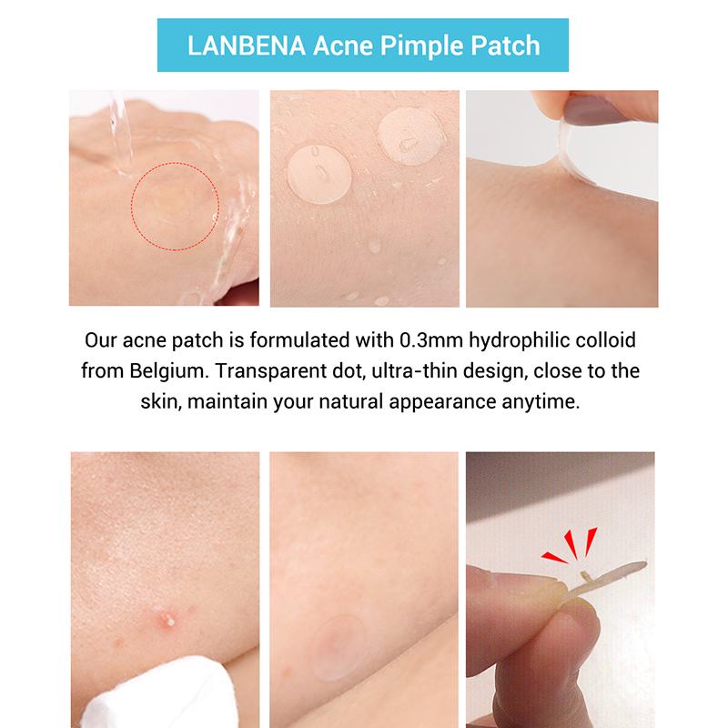 Acne Patches with Tea Tree Oil - Fade Acne Marks & Blemishes Fast